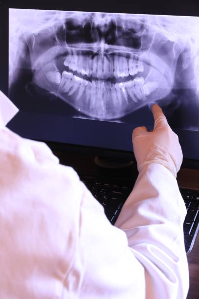 Best Emergency Treatment for Dental Infections or Abscesses in Chetopa, KS