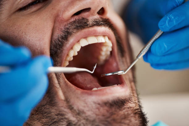 Best Emergency Dental Care for Broken or Chipped Teeth in Chetopa, KS